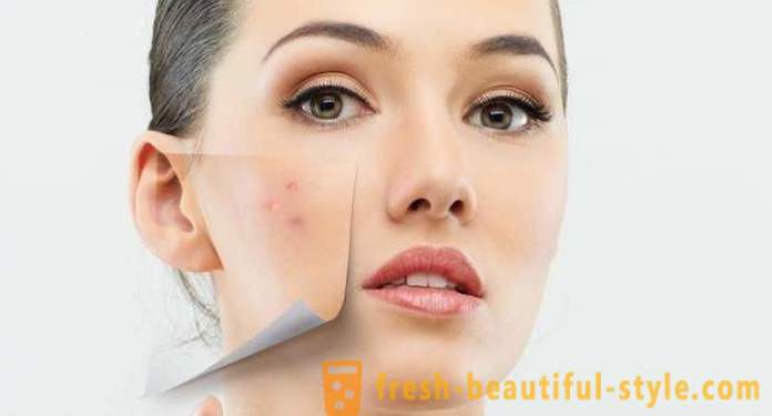 Les taches brunes sur le visage: les causes et les traitements. Les taches brunes