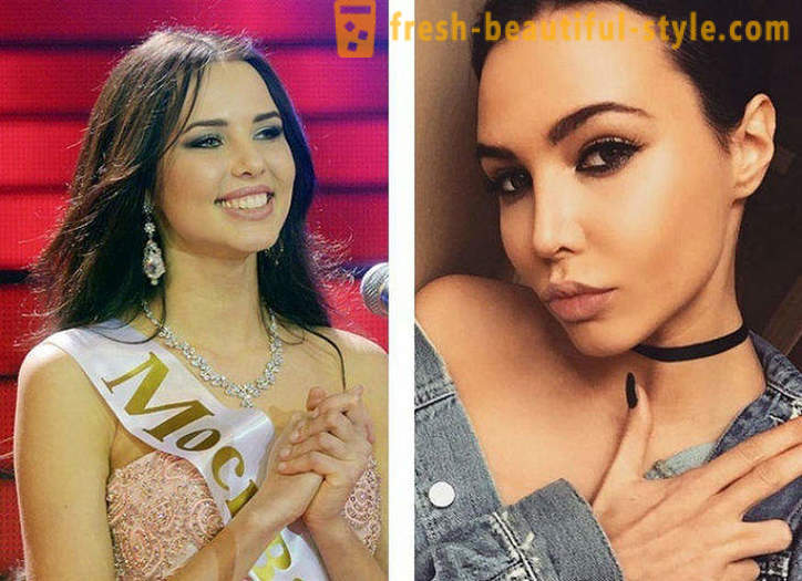 10 beautés russes avant et après plastique