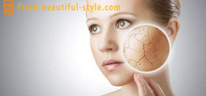 La peau squameuse sur le visage et les mains: les causes possibles et les caractéristiques des soins
