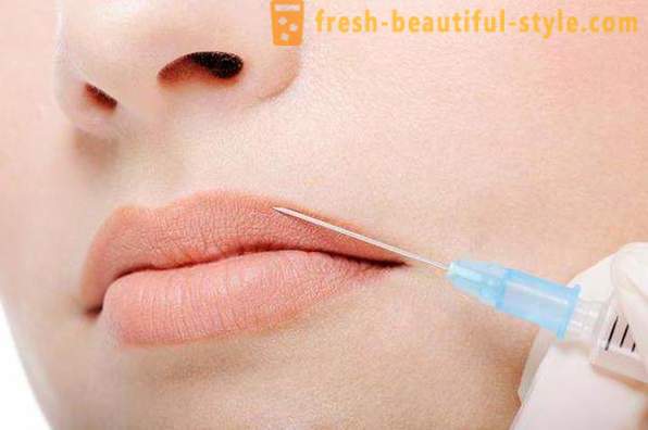 Comment nettoyer les rides sur la lèvre supérieure en cosmétologie?