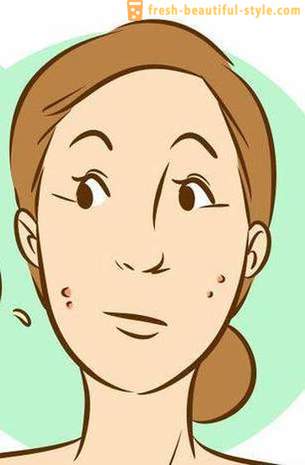 Comment enlever la rougeur d'une Pimple rapide