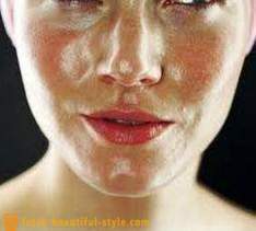 Le visage de la peau grasse: ce qu'il faut faire pour régler le problème?