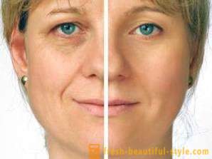 Wrinkles sous les yeux: comment éliminer et prévenir l'apparition précoce?